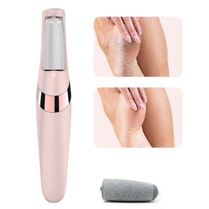Electric Pedicure Foot File – Rechargeable Callus Remover